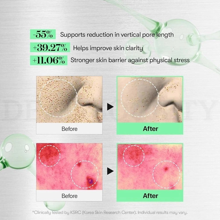 VT CICA Reedle Shot Serum