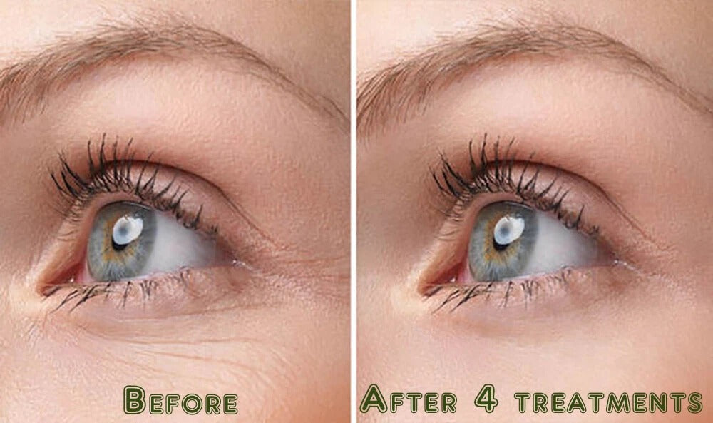 Pure Hyaluronic Acid Anti-Aging Serum