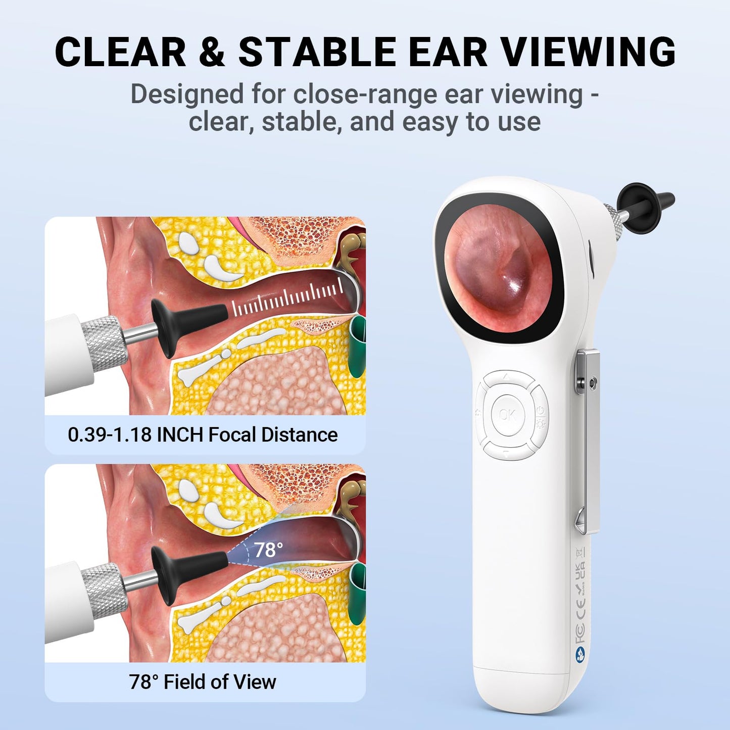 ScopeAround Digital Otoscope w/Built-in Screen, Manual-Focus Digital Otoscope with Light for Home Use, No App Needed, Easy Viewing for Everyday Ear Checks, Otoscope Camera, White