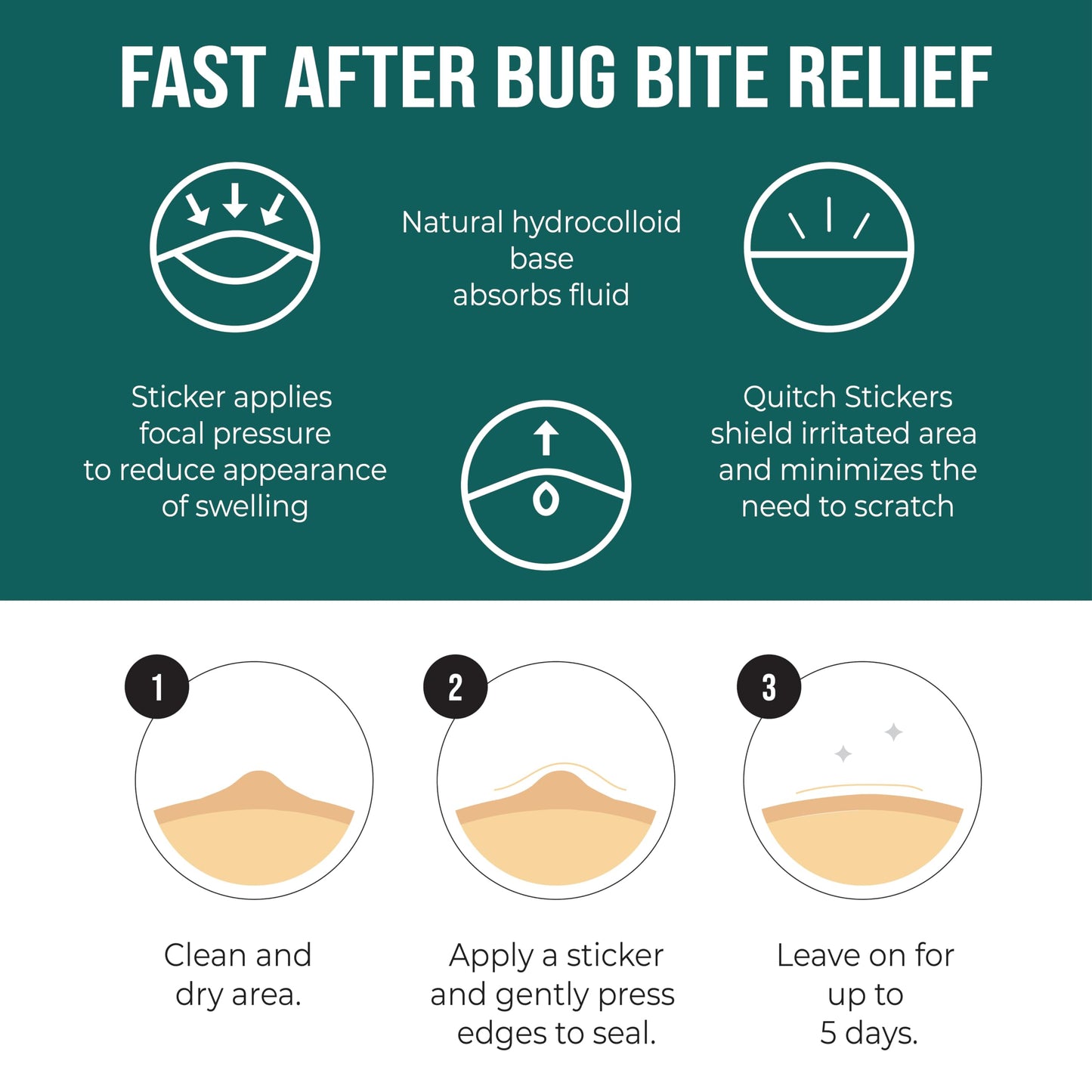 quitch Mosquito Bite Relief Magic Theme Patches, Bug Bite Anti Itch Cream Alternative for Kids and Baby, Insect Bite Relief, After Bite Relief, Travel Essential for Summer Camp, Cruise and Outdoors