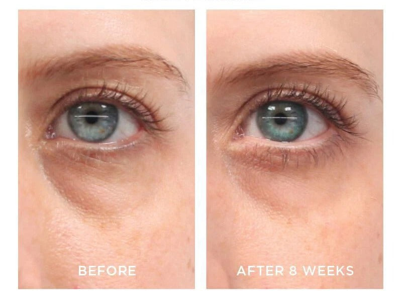 Pure Retinol Vitamin A Serum